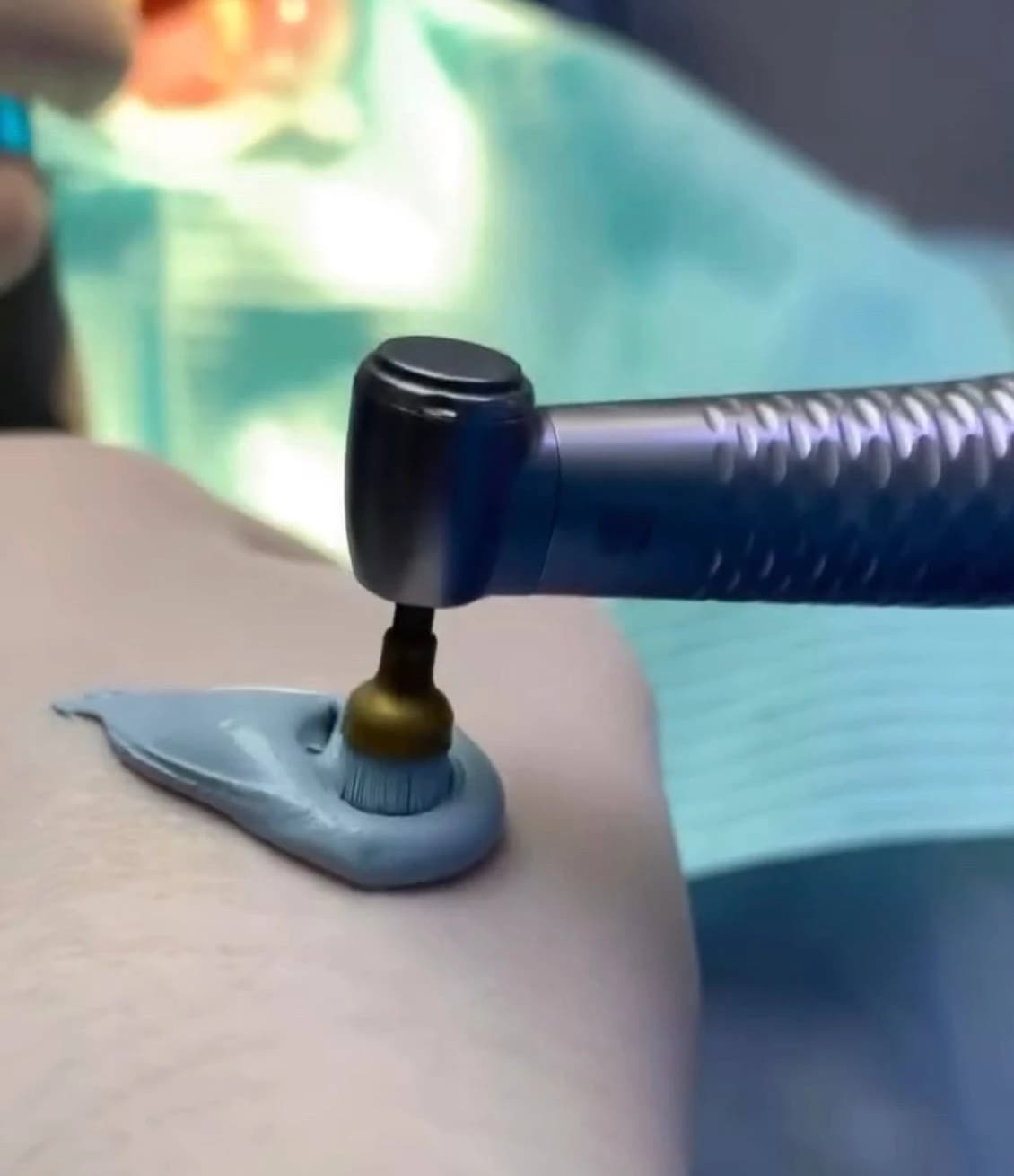 Полірування зубів щіткою з пастою