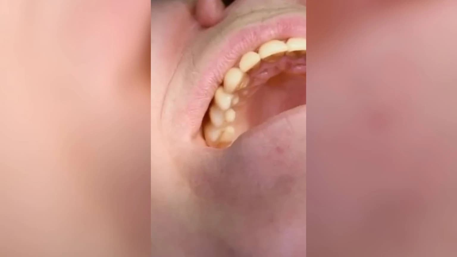 Після лікування