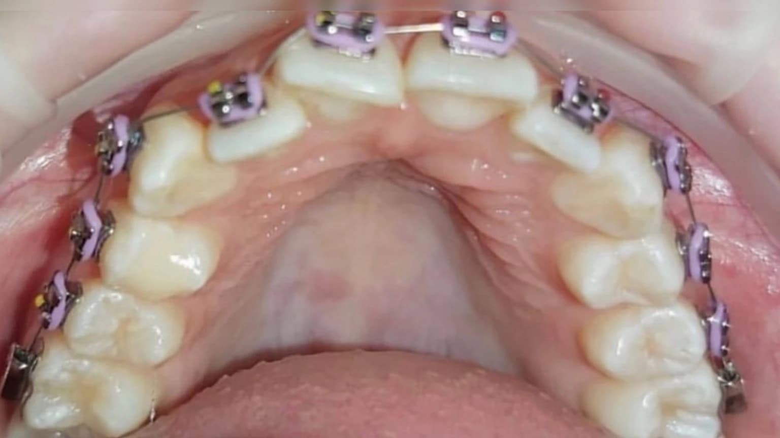 До ретенційного періоду